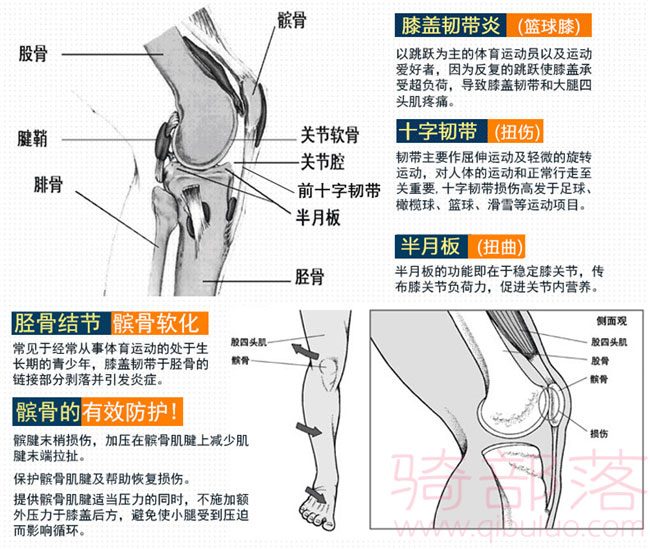 膝盖的常见损伤